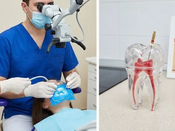 Endodoncia tratamiento conductos salvar diente Ibagué Dr Edwin Riaño